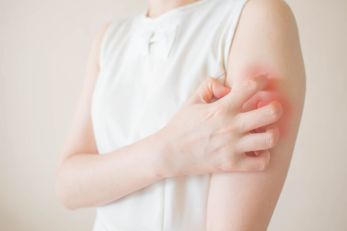 Irritant VS. Allergic Contact Dermatitis: What's the Difference