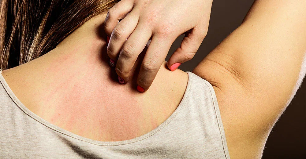 5 Reasons Why You are Allergic to Certain Clothing and  What You can do to Resolve it