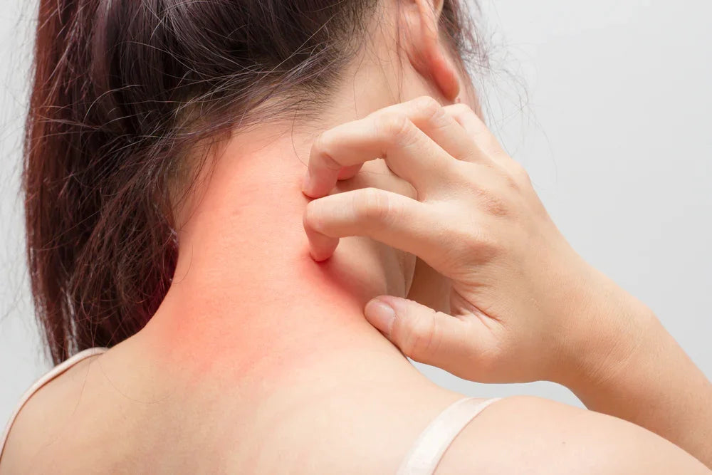 Woman scratching irritated red skin on neck, allergy reaction to clothing fabrics