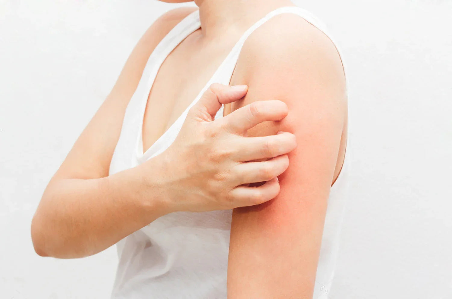 Person scratching irritated, red skin on arm, symptom of eczema or sensitive skin allergy