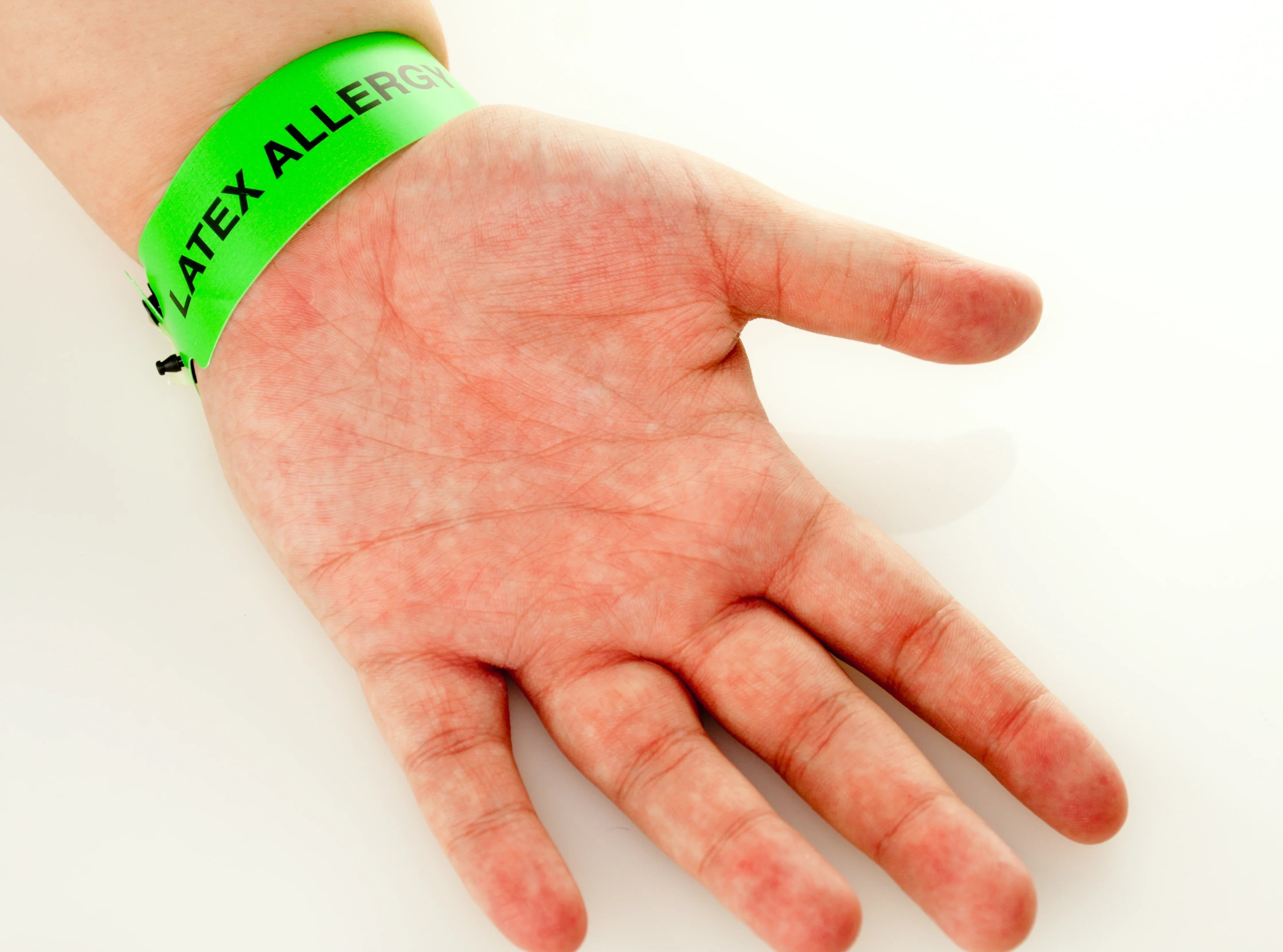 Open hand wearing a green latex allergy wristband on a white background, hypoallergenic focus