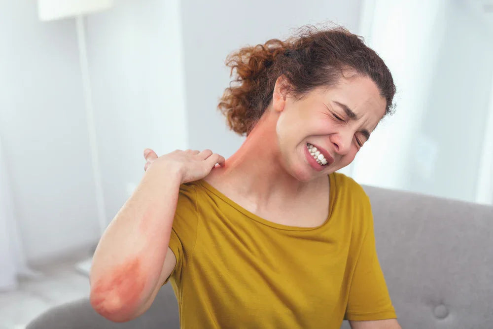 Woman scratching neck and arm with visible skin irritation, eczema, or allergy symptoms