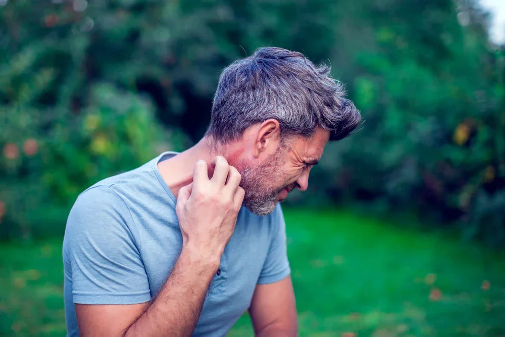 Man in blue shirt scratching neck outdoors, showing allergy or skin irritation