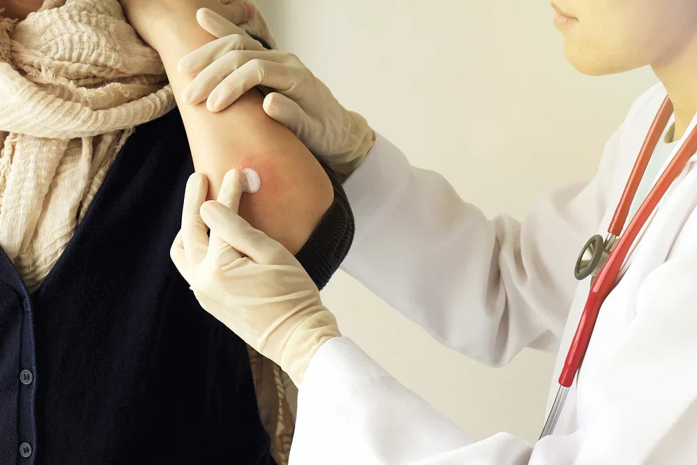 Doctor applying allergy test patch on patient’s arm, hypoallergenic apparel concept