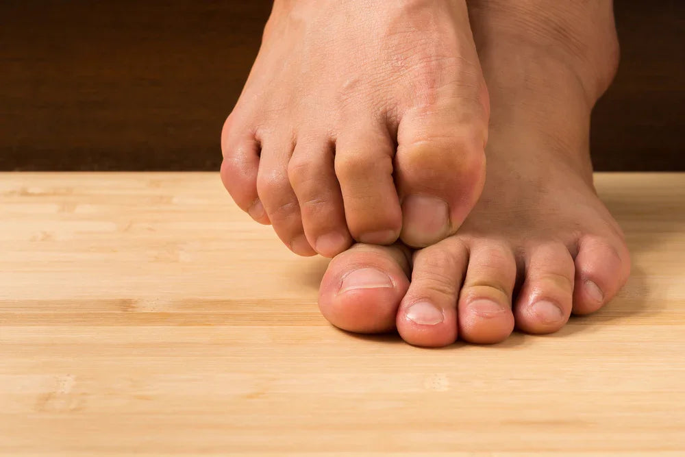 Bare feet on wooden floor, person scratching toes, allergy or skin irritation concept