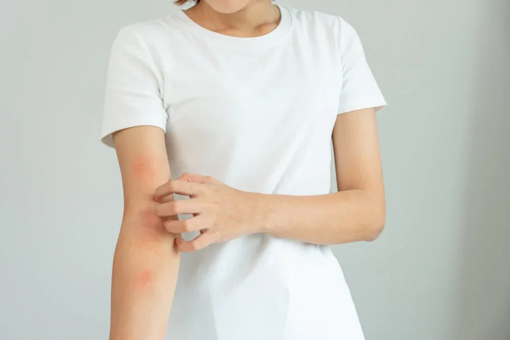 Woman scratching red irritated skin on forearm while wearing a white cotton t-shirt