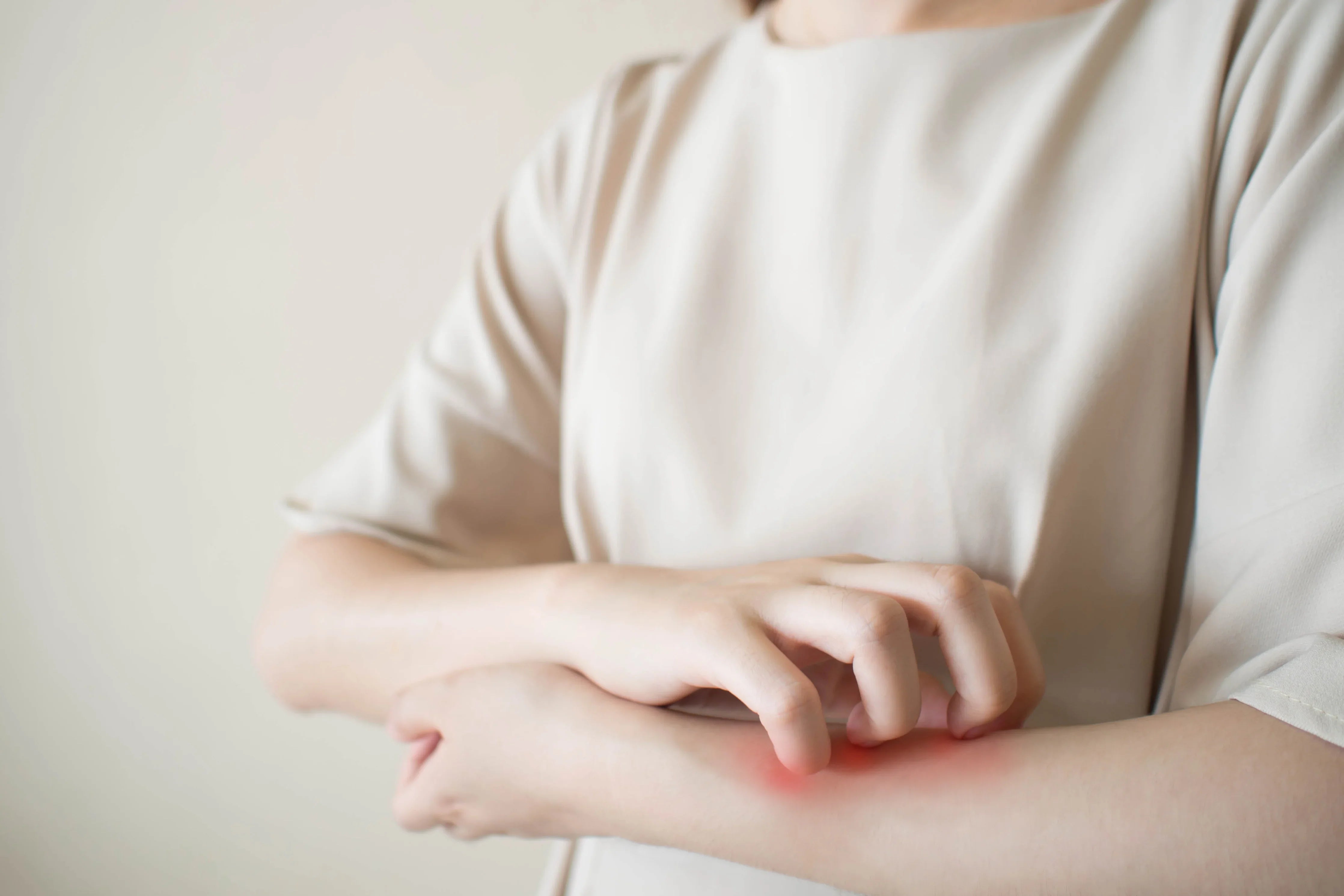 Woman scratching her arm due to skin irritation, wearing light organic cotton clothing
